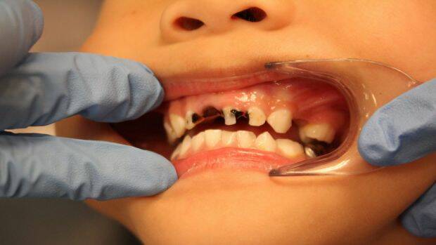 Call for more dental services