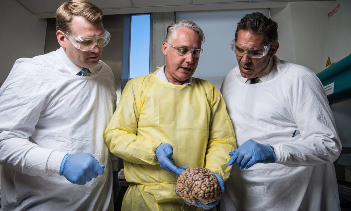 Michael Buckland of RPA, Chris Nowinski from Concussion Legacy Foundation and former rugby player Colin Scotts examine a brain. Picture: Wolter Peeters