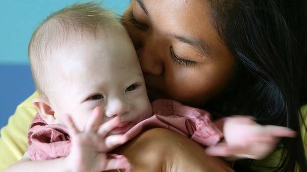Pattaramon Chanbua, right, kisses her baby boy Gammy at a hospital in Chonburi province, Thailand. Photo: AP